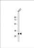 Western Blot at 1:1000 dilution + A431 whole cell lysate Lysates/proteins at 20 ug per lane.