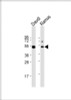 Western Blot at 1:8000 dilution Lane 1: Daudi whole cell lysate Lane 2: Ramos whole cell lysate Lysates/proteins at 20 ug per lane.