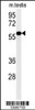 Western blot analysis in mouse testis tissue lysates (35ug/lane) .This demonstrates the detected DKC1 protein (arrow) .