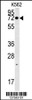 Western blot analysis in K562 cell line lysates (35ug/lane) .