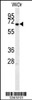 Western blot analysis in WiDr cell line lysates (15ug/lane) .This demonstrates the MEIS2 antibody detected the MEIS2 protein (arrow) .