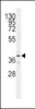 Western blot analysis in mouse kidney tissue lysates (15ug/lane) .This demonstrates the detected SRD5A2 protein (arrow) .