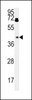 Western blot analysis in HepG2 cell line lysates (15ug/lane) .