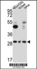 Western blot analysis in NCI-H292, Jurkat cell line and mouse liver lysates (15ug/lane) .