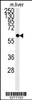 Western blot analysis in mouse liver tissue lysates (15ug/lane) .This demonstrates the detected PCYXL protein (arrow) .