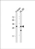 Western Blot at 1:1000 dilution Lane 1: human brain lysate Lane 2: HL-60 whole cell lysate Lysates/proteins at 20 ug per lane.