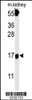 Western blot analysis in mouse kidney tissue lysates (15ug/lane) .This demonstrates the detected FGFBP3 protein (arrow) .