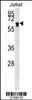 Western blot analysis in Jurkat cell line lysates (15ug/lane) .