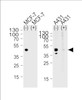 Western blot analysis of lysate from MCF-7, A431 cell line, using CALCR Antibody with (+) or without (-) peptides at 1:1000 at each lane. A goat anti-rabbit (HRP) at 1:5000 dilution was used as the secondary antibody. Lysate at 35ug per lane.