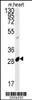 Western blot analysis in mouse heart tissue lysates (15ug/lane) .This demonstrates the detected APOBEC2 protein (arrow) .