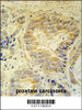 FAM105B Antibody immunohistochemistry analysis in formalin fixed and paraffin embedded human prostate carcinoma followed by peroxidase conjugation of the secondary antibody and DAB staining.