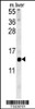 Western blot analysis in mouse liver tissue lysates (15ug/lane) .This demonstrates the detected GAL protein (arrow) .