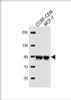 Western Blot at 1:2000 dilution Lane 1: CCRF-CEM whole cell lysate Lane 2: MCF-7 whole cell lysate Lysates/proteins at 20 ug per lane.