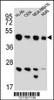 Western blot analysis in HL-60, CEM, MDA-MB435, A549 cell line lysates (15ug/lane) .