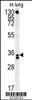 Western blot analysis in mouse lung tissue lysates (15ug/lane) .This demonstrates the detected RCN3 protein (arrow) .