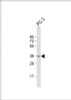 Western Blot at 1:1000 dilution + PC-3 whole cell lysate Lysates/proteins at 20 ug per lane.