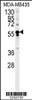 Western blot analysis in MDA-MB435 cell line lysates (35ug/lane) .