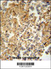 ZMYND10 Antibody immunohistochemistry analysis in formalin fixed and paraffin embedded human testis carcinoma followed by peroxidase conjugation of the secondary antibody and DAB staining.