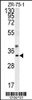 Western blot analysis in ZR-75-1 cell line lysates (35ug/lane) .