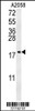 Western blot analysis in A2058 cell line lysates (35ug/lane) .