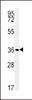 Western blot analysis in WiDr cell line lysates (35ug/lane) .