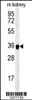 Western blot analysis in mouse kidney tissue lysates (35ug/lane) .