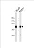 Western Blot at 1:1000 dilution Lane 1: LNCaP whole cell lysate Lane 2: SW620 whole cell lysate Lysates/proteins at 20 ug per lane.