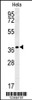 Western blot analysis in Hela cell line lysates (35ug/lane) .