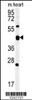 Western blot analysis in mouse heart tissue lysates (15ug/lane) .This demonstrates the detected ACSF3 protein (arrow) .