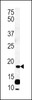 Western blot analysis in CEM cell line lysates (35ug/lane) .