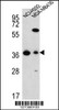 Western blot analysis in NCI-H292, MDA-MB435 cell line lysates (35ug/lane) .