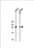 Western blot analysis of lysates from A431, Hela cell line (from left to right) , using SFN Antibody at 1:1000 at each lane.