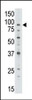 Antibody is used in Western blot to detect ABCB7 in Jurkat cell lysate.