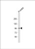 Western Blot at 1:2000 dilution + human ovary lysate Lysates/proteins at 20 ug per lane.