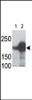 LRP5 Antibody is used in Western blot to detect recombinant human LRP5 (Lane 1) and mouse LRP5 (Lane 2) proteins in transfected 293 cell lysates. Data is kindly provided by Drs. V. Harris and S. Aaronson from the Mount Sinai School of Medicine (New York, NY) .