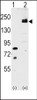 Western blot analysis of LRP6 using rabbit polyclonal LRP6 Antibody (C-term T1546) using 293 cell lysates (2 ug/lane) either nontransfected (Lane 1) or transiently transfected with the LRP6 gene (Lane 2) .