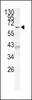 Western blot analysis of AF9 (M in 293 cell line lysates (35ug/lane) .