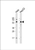 Western Blot at 1:1000 dilution Lane 1: Hela whole cell lysate Lane 2: HepG2 whole cell lysate Lysates/proteins at 20 ug per lane.