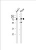 Western blot analysis of lysates from A431, Hela cell line (from left to right) , using SEPT9 Antibody at 1:1000 at each lane.