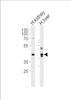 Western blot analysis of lysates from human kidney and liver tissue lysate (from left to right) , using SEPT9 Antibody at 1:1000 at each lane.