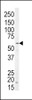 Western blot analysis of anti-NRG1 Antibody in SK-BR-3 cell line lysates (35ug/lane)