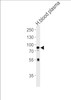 Western blot analysis in human blood plasma tissue lysates (35ug/lane) .