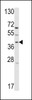 Western blot analysis of hRai3-W343 in T47D cell line lysates (35ug/lane)