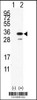 Western blot analysis of PDAP1 using rabbit polyclonal PDAP1 Antibody using 293 cell lysates (2 ug/lane) either nontransfected (Lane 1) or transiently transfected with the PDAP1 gene (Lane 2) .