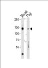 Western blot analysis in Daudi, Raji cell line lysates (35ug/lane) .This demonstratdetected the Rb protein (arrow) .