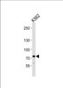 Western blot analysis of lysate from K562 cell line, using SOX30 Antibody at 1:1000 at each lane.