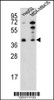 Western blot analysis of PARP16 Antibody in HepG2, MDA-MB435 cell line lysates (35ug/lane)