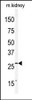 Western blot analysis of anti-CLDN2 Antibody in mouse kidney tissue lysates (35ug/lane) .