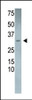 Antibody is used in Western blot to detect DSCR1L2 in mouse heart tissue lysate.