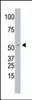 Antibody is used in Western blot to detect SPPL2a in Jurkat cell lysate.